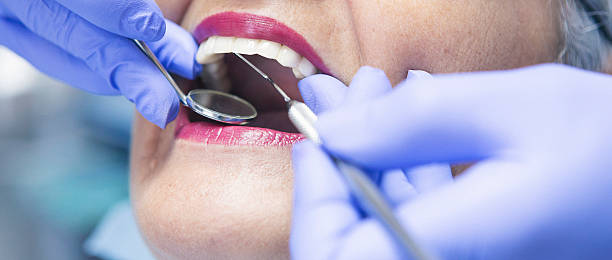 Best Emergency Dentist for Lost Fillings or Crowns in Amory, MS