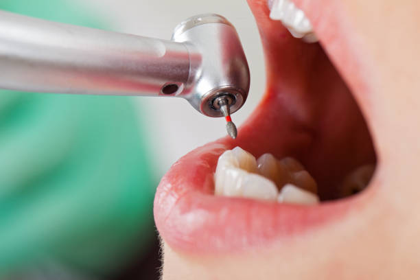Best Urgent Dental Care for Toothache in Amory, MS